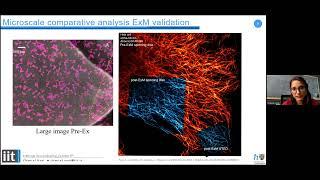 Expansion Microscopy User Group Meeting - October 2022
