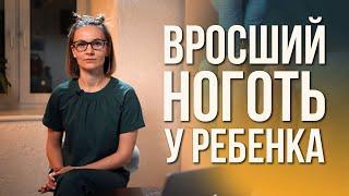 Вросший ноготь у детей и подростков – Что делать и как ухаживать за стопами?