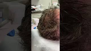 Hair Restoration featuring. Beauty Booster and WorldPRP