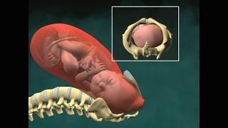 El Parto Vaginal (coronación)