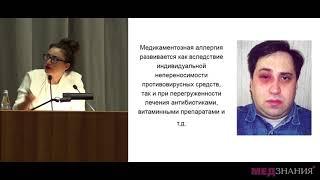 3. «Герпетические поражения роговицы» Е. А. Каспарова