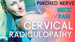 I Cured My Cervical Radiculopathy (Neck & Nerve Pain) & You Can Too