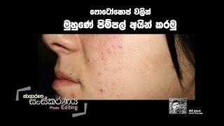 How to Remove Pimples - Photoshop Sinhala Tutorial