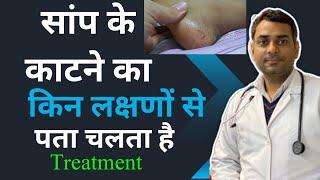 सांप के काटने पर क्या लक्षणों से पता चलता है symptoms after snake bite