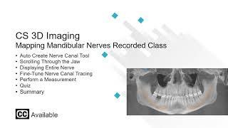 CS 3D Imaging: Mapping Mandibular Nerves Recorded Class