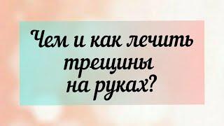 Чем и как лечить трещины на руках?