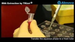 RNA Extraction by TRIzol®