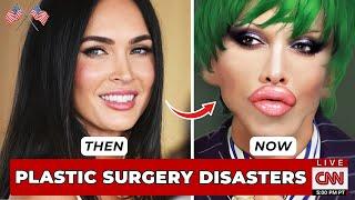 8 Famous Celebrities Unrecognizable After Failed Plastic Surgery - WHO DIED TODAY! NEWS