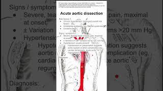 Acute aortic dissection