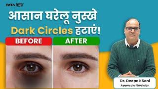 No More Dark Circles! Simple Home Remedies That Work