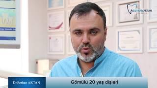 Gömülü 20 yaş dişleri