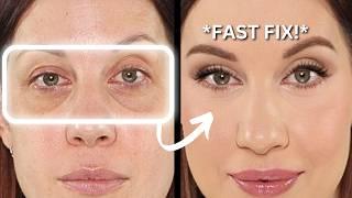 Dark Circles & Hollow Under Eyes? Try These Fast Fixes!