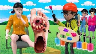 Scary Teacher 3D vs Squid Game Feet Treatment with Doll and Granny or Error 5 Times Challenge