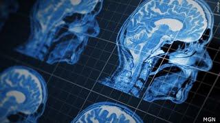 Michigan radiologist warns about ‘incidental findings’ in full body MRI scans