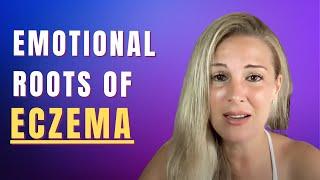 Emotional Root Causes Behind Eczema by Evette Rose - August 2021