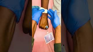 Intravenous cannulation techniques #nurse #doctor #hospital #shorts #training #trending #world