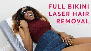 FULL Bikini and Perianal - Laser Hair Removal (Live Treatment)