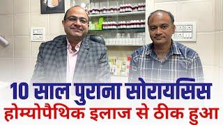 Psoriasis Homoeopathy treatment |सोराईसिस का ईलाज| Psoriasis doctor