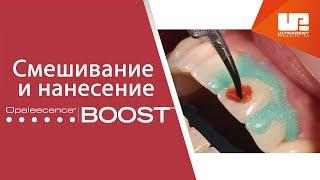 Смешивание и нанесение офисного отбеливания Opalescence™ Boost™