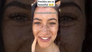 Freckles so beautiful #explore #trending #video #shortsvideo #shorts