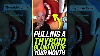 Pulling a Thyroid Out of Your Mouth  #shorts