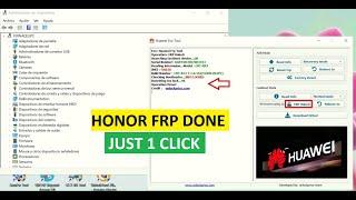  HONOR Pad X8a FRP Unlock | (NDL-W09) | Google Account Remove | Just One Click #UnlockPrice