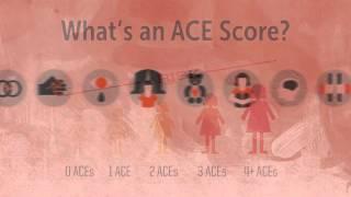 ACES Primer HD