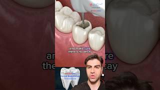 Tooth Filling: A Fun Animated Overview!