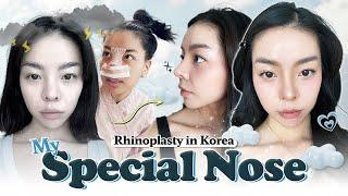 I got a new nose in Korea and I LOVE it! | Nana's rhinoplasty at Braun PART 1 