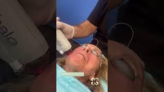 #Halo Treatment - The Kaplan Center - NYC, NJ #aesthetics #beauty #bodycontouring #Laser
