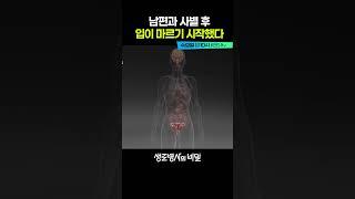 남편을 그리워하다 생긴 병