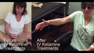 Dr. Hanna treats CRPS patient with his groundbreaking IVKetamine treatment