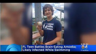 Florida Teen Infected With Brain-Eating Amoeba