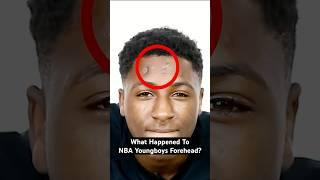 What happened to NBA YoungBoy's forehead? 