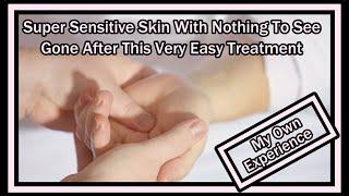 Very Sensitive Skin / Painful Skin With Nothing To See - Gone After This Easy Treatment