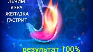 Лечим желудок, язву, гастрит 100% ИСЦЕЛЕНИЕ