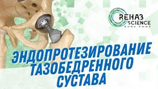 Эндопротезирование тазобедренного сустава: Протокол реабилитации