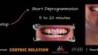 CENTRIC RELATION- Determining CR; EPISODE 2