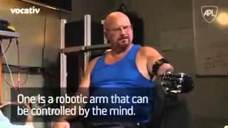 Incredible Robotic Arm controlled by brain