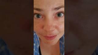 Диабетик, смотри в мои глаза #диабет #ретинопатия