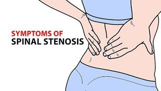 Symptoms of Spinal Stenosis