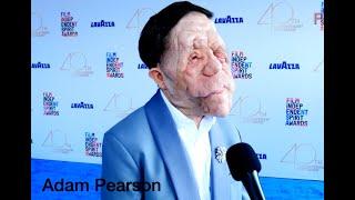 Adam Pearson arrives at the 2025 Film Independent Spirit Awards