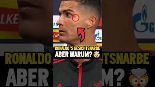 Wunde auf Ronaldos Gesicht – Warum?  #shorts #Fußball #Ronaldo