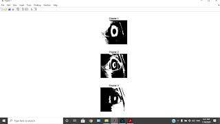 Eye Cataract Detection using Digital Image Processing || Engineering Project || Final Year Project |