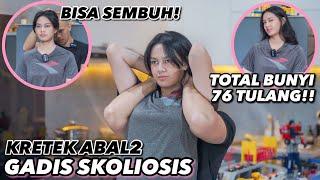 KRETEK ABAL2 GADIS SKOLIOSIS, TULANGNYA BISA LURUS LAGI!