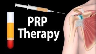 PRP Therapy Animation