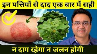 पुराने से पुराना दाद एक बार में हो जायेगा सही | Best Remedy For Fungal Skin Infection