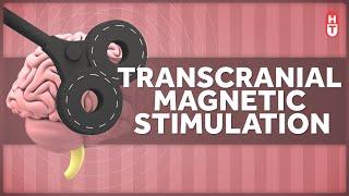 Transcranial Magnetic Stimulation: How Does that Work?