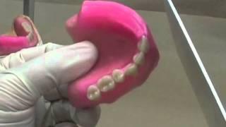 30 Setting Denture Teeth -  Adjusting Rims