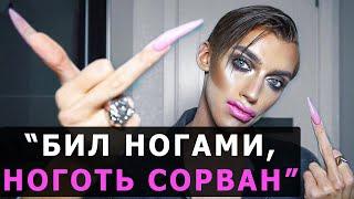 Андрея Петрова избили. Бьюти-блогер Андрей Петров рассказал о драке и назвал причину.